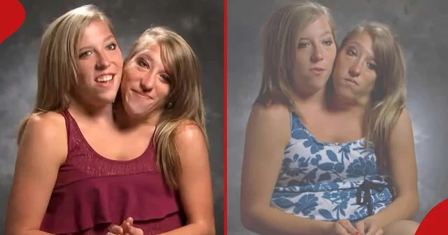 Abby and Brittany: Conjoined Twins Who Paid Separate Fees Earn One Salary After Becoming Teachers